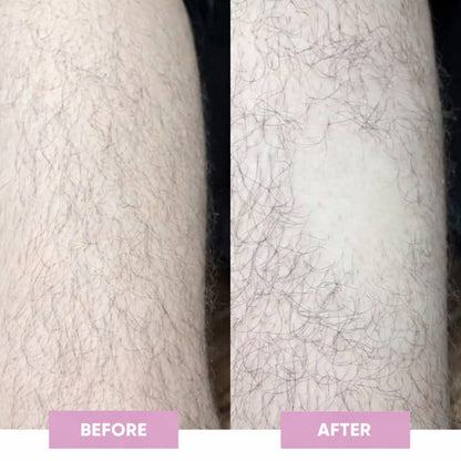 Blair Crystal Hair Eraser