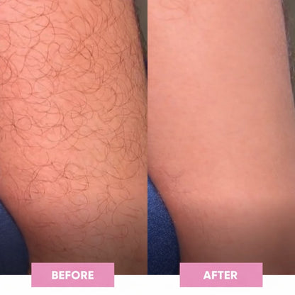 Blair Crystal Hair Eraser